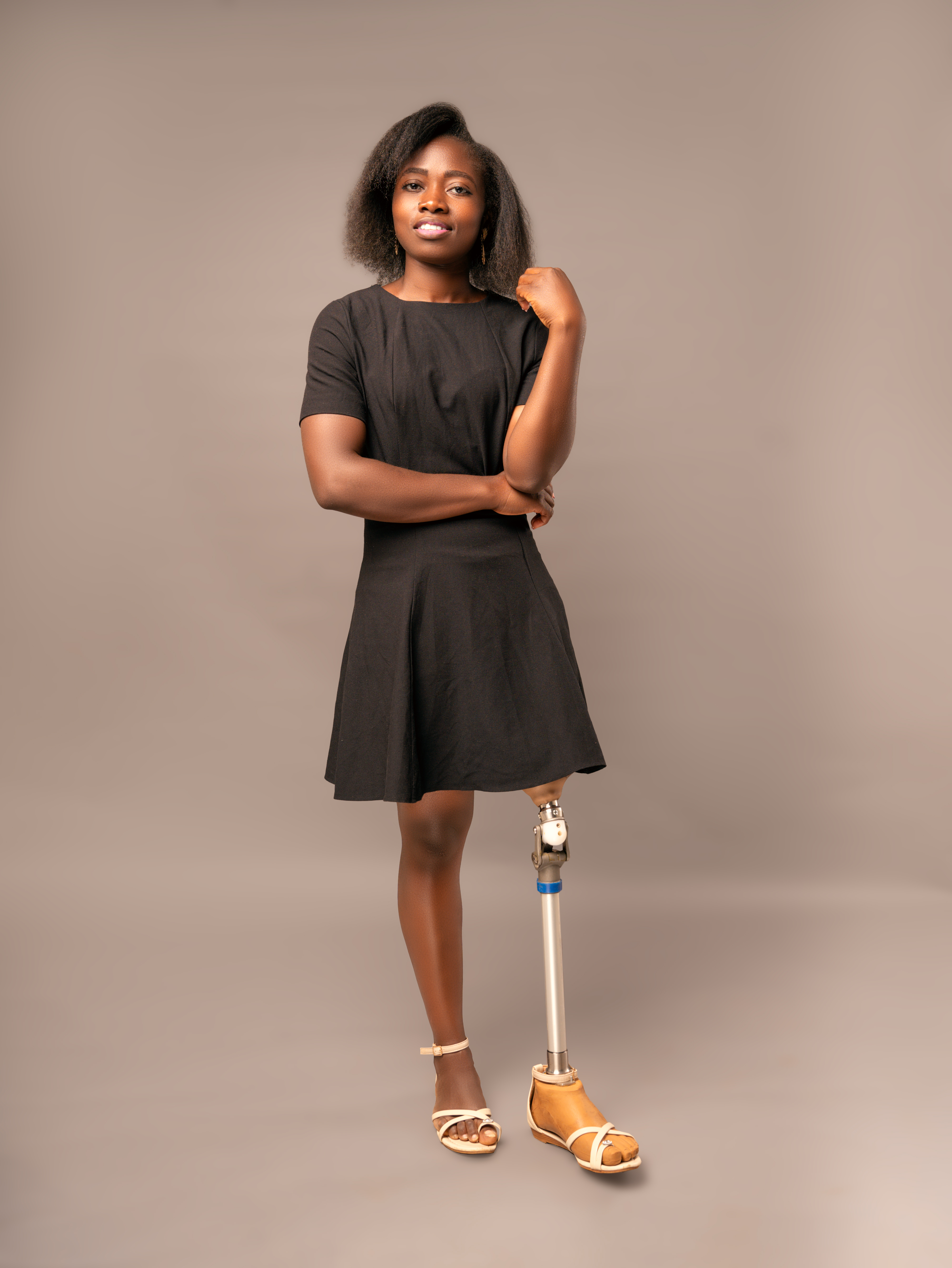 My Journey with Neurofibroma, Amputation and Life Beyond