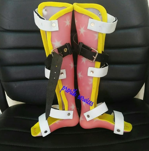 Knee Ankle Foot Orthosis (KAFO) fitting
