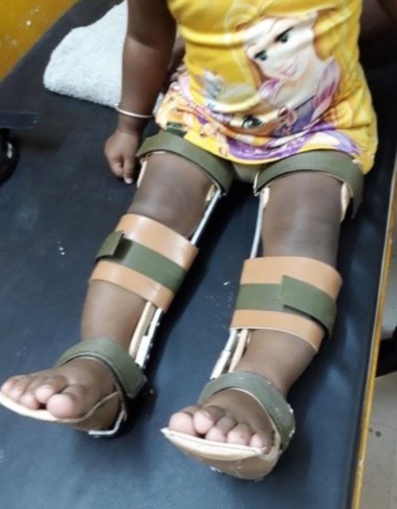 Hand splint for rehabilitation