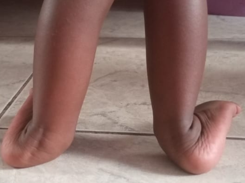 Foot condition assessment